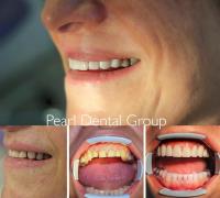 Pearl Dental Group image 3